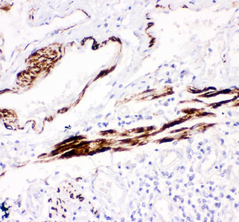 Anti-Desmin Antibody