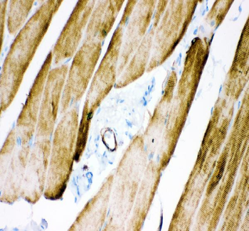 Anti-Desmin Antibody