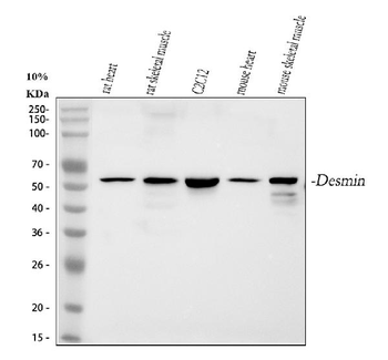 Anti-Desmin Antibody