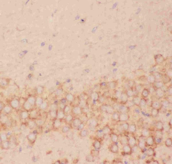 Anti-FSH beta/FSHB Antibody
