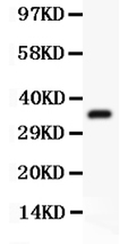 Anti-FSH beta/FSHB Antibody