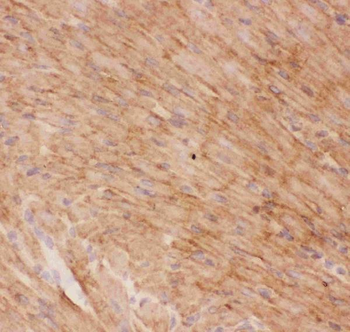 Anti-Glucose Transporter GLUT4/SLC2A4 Antibody
