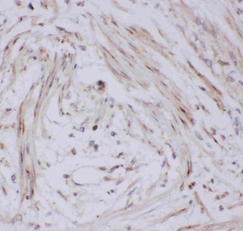 Anti-Glucose Transporter GLUT4/SLC2A4 Antibody