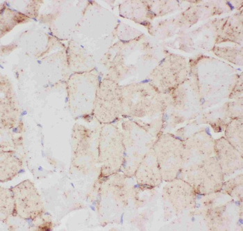 Anti-Glucose Transporter GLUT4/SLC2A4 Antibody