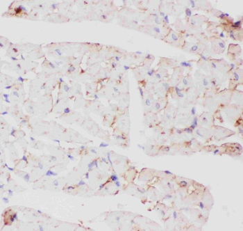 Anti-Glucose Transporter GLUT4/SLC2A4 Antibody
