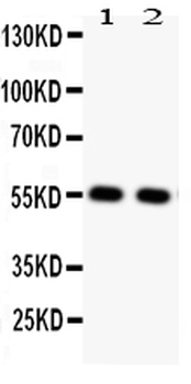 Anti-Glucose Transporter GLUT4/SLC2A4 Antibody