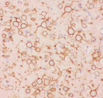Anti-Kv2.1/KCNB1 Antibody