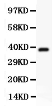 Hamartin/TSC1 Antibody