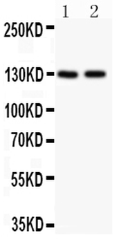 Anti-Hamartin/TSC1 Antibody