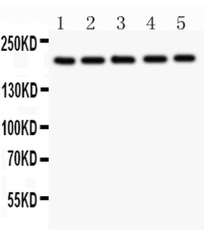 Tuberin/TSC2 Antibody