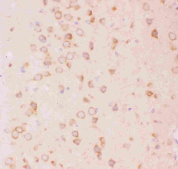 Anti-Tuberin/TSC2 Antibody