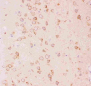 Tuberin/TSC2 Antibody