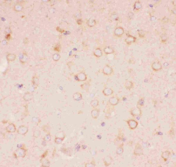 Anti-Tuberin/TSC2 Antibody