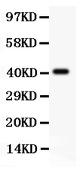 Anti-Tuberin/TSC2 Antibody