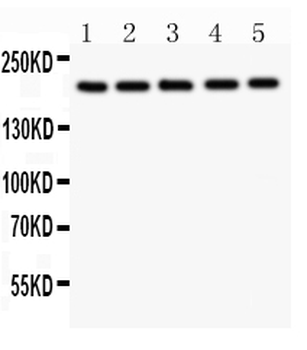 Anti-Tuberin/TSC2 Antibody