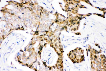 Anti-Ubiquitin/UBB Antibody