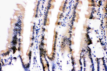 Anti-Ubiquitin/UBB Antibody