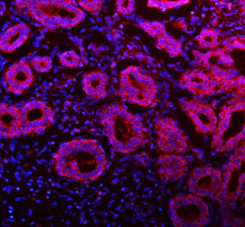 Anti-NDUFA9 Antibody