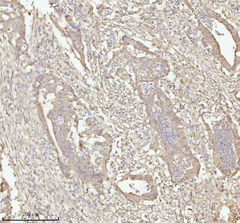 Anti-NDUFA9 Antibody