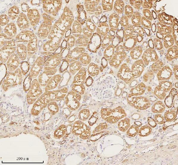 Anti-NUDT19 Antibody