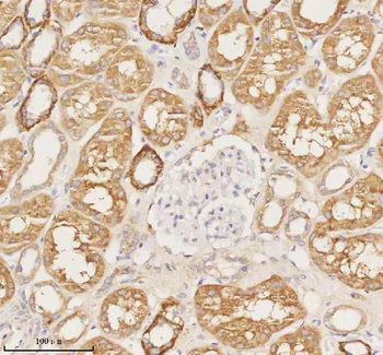 Anti-NUDT19 Antibody