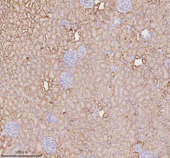 Anti-NUDT19 Antibody
