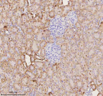 Anti-NUDT19 Antibody
