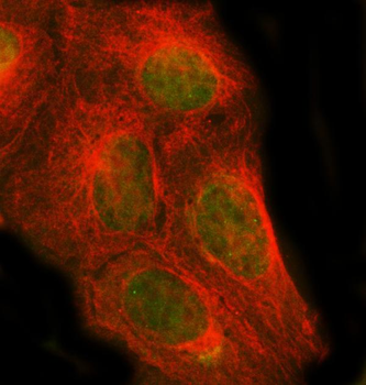 Anti-PSMC1 Antibody