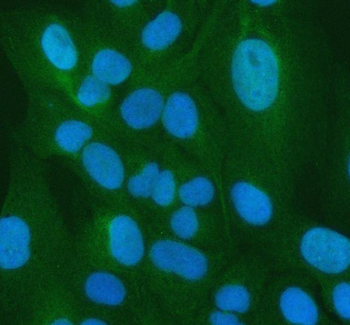 Anti-PSMA5 Antibody