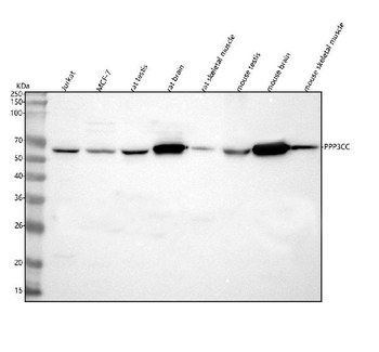 Anti-PPP3CC Antibody