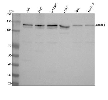 Anti-SAPS3/PPP6R3 Antibody