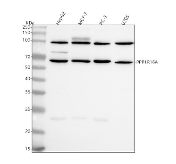Anti-PPP1R16A Antibody