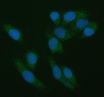 PPEF1 Antibody