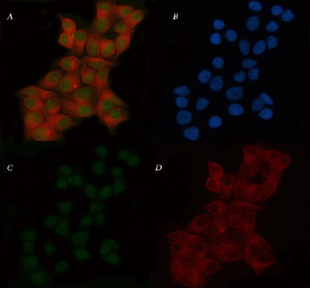 Anti-POLR3D Antibody