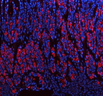 ATP4B Antibody