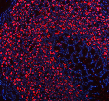 ATP4B Antibody
