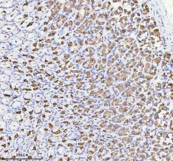 ATP4B Antibody