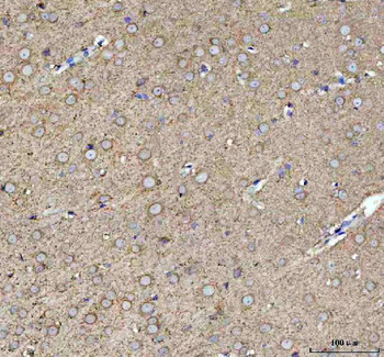 Anti-POMGNT1 Antibody