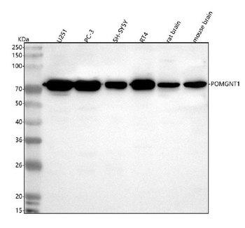 Anti-POMGNT1 Antibody