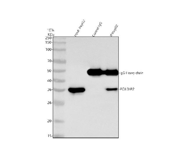 POLDIP2 Antibody