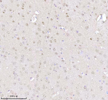 Anti-MECP2 Antibody