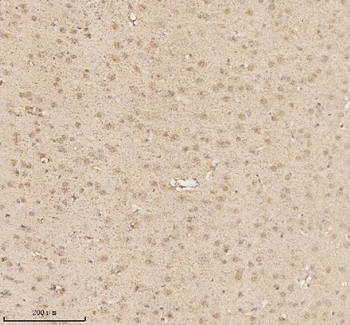 Anti-MECP2 Antibody