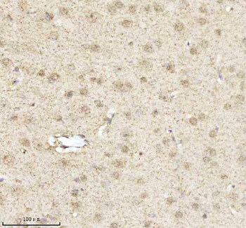 Anti-MECP2 Antibody