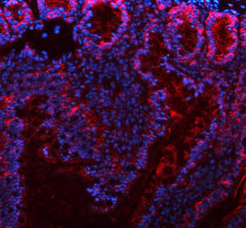 Anti-E-cadherin/Cdh1 Antibody