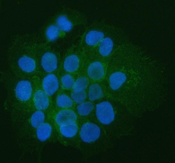 Anti-CD44 Antibody