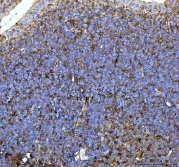 Anti-CD44 Antibody