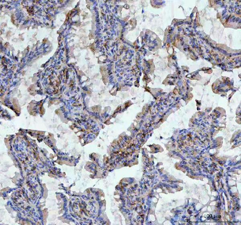 Anti-CD44 Antibody