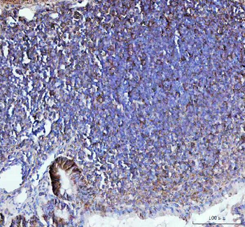 Anti-CD44 Antibody