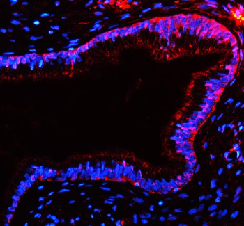 Anti-TAS2R10 Antibody
