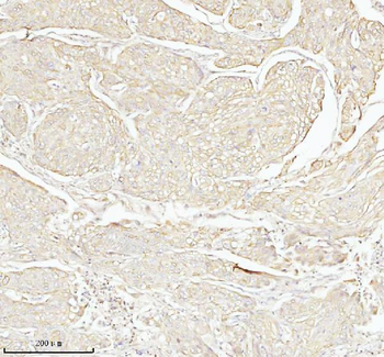Anti-TAS2R10 Antibody